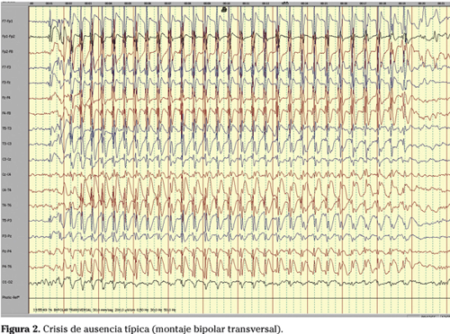 EEG.png